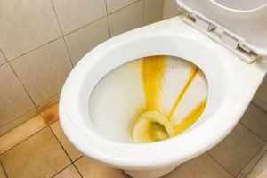 Dirty toilet bowl with limescale stain deposits, limescale, water stains