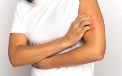 Itchy Skin? The Reason Might Not Be What You Think